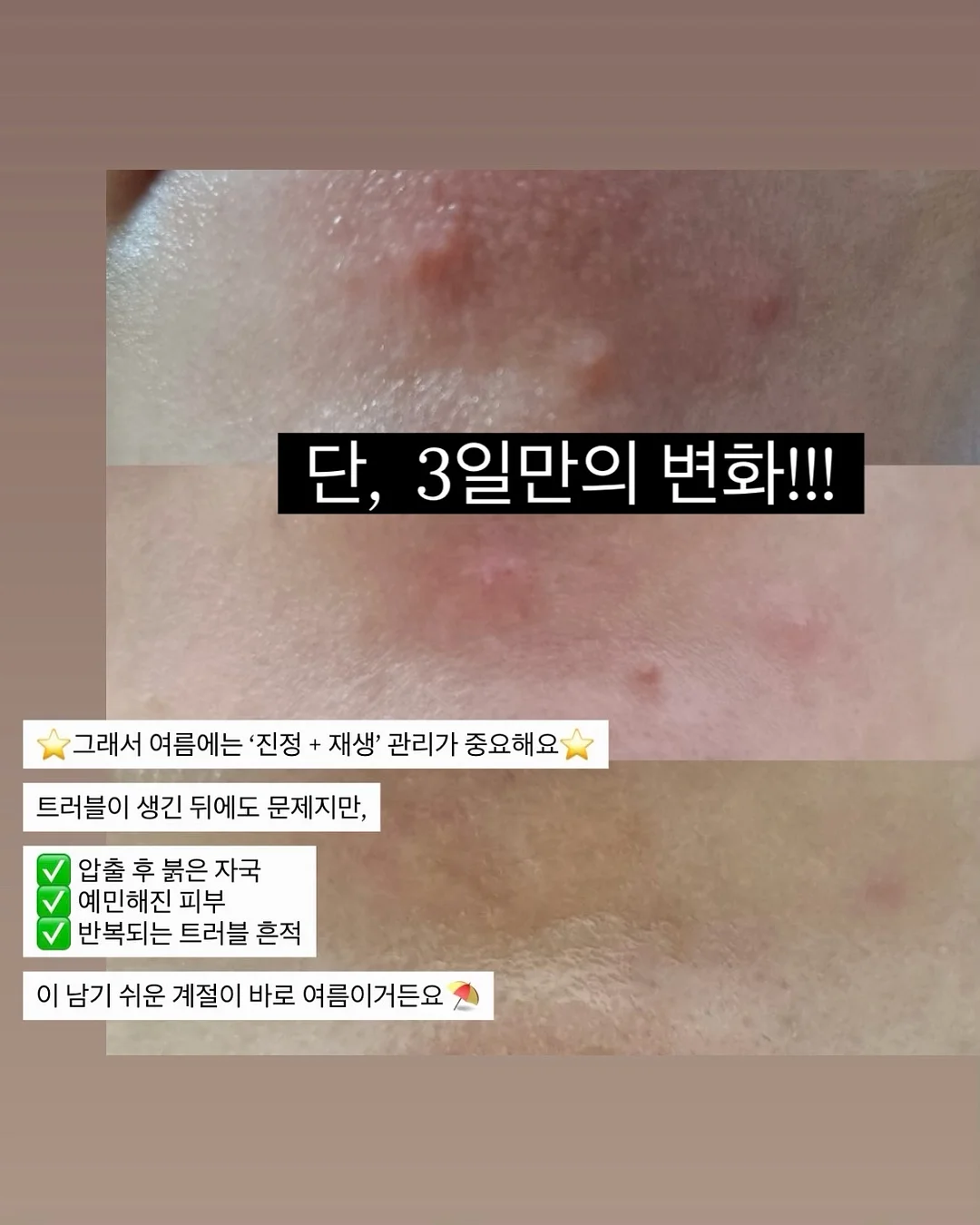 차일드라이프 멀티비타민&미네랄 3