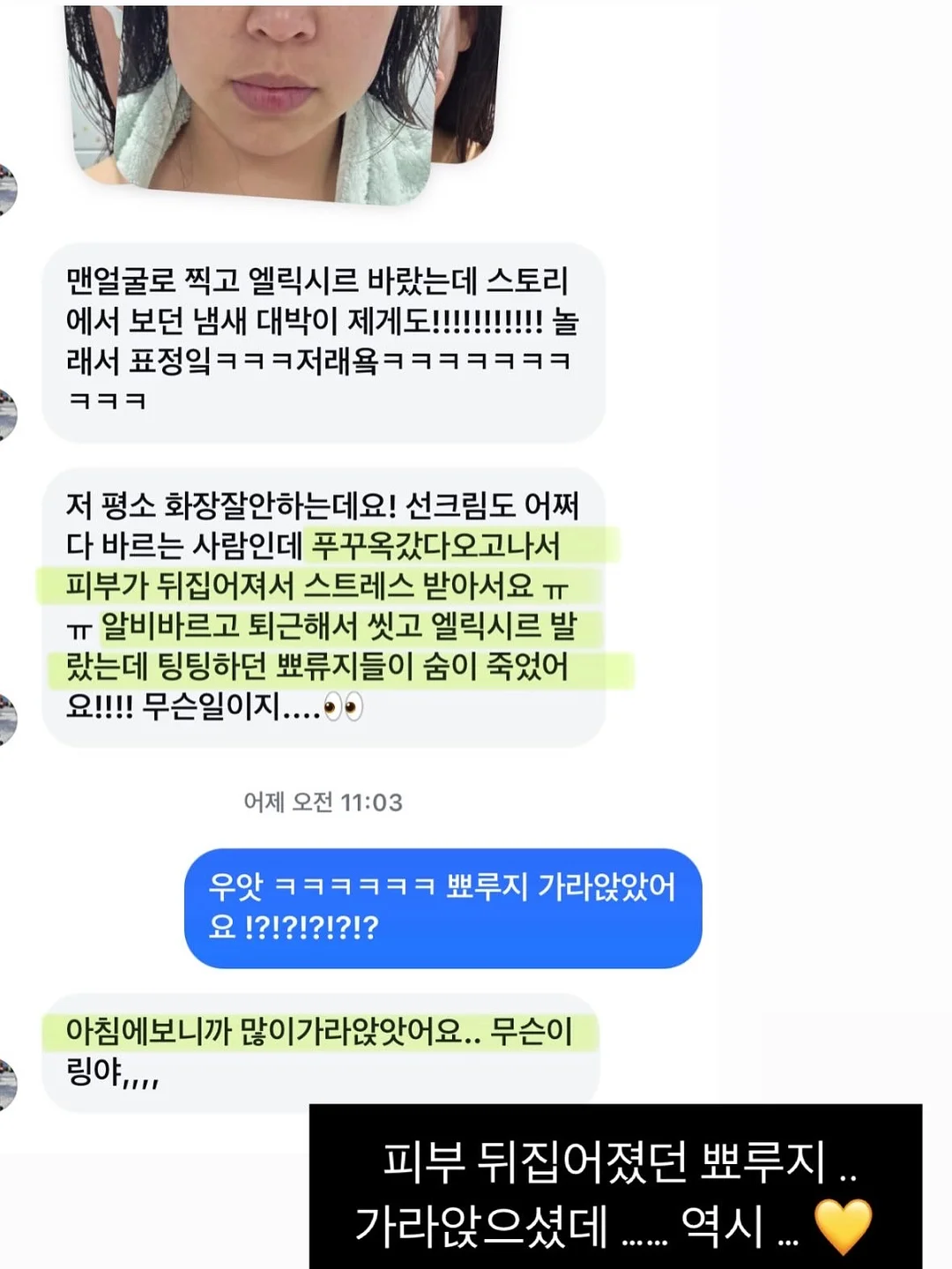 여름 하프 기장 아이템 11