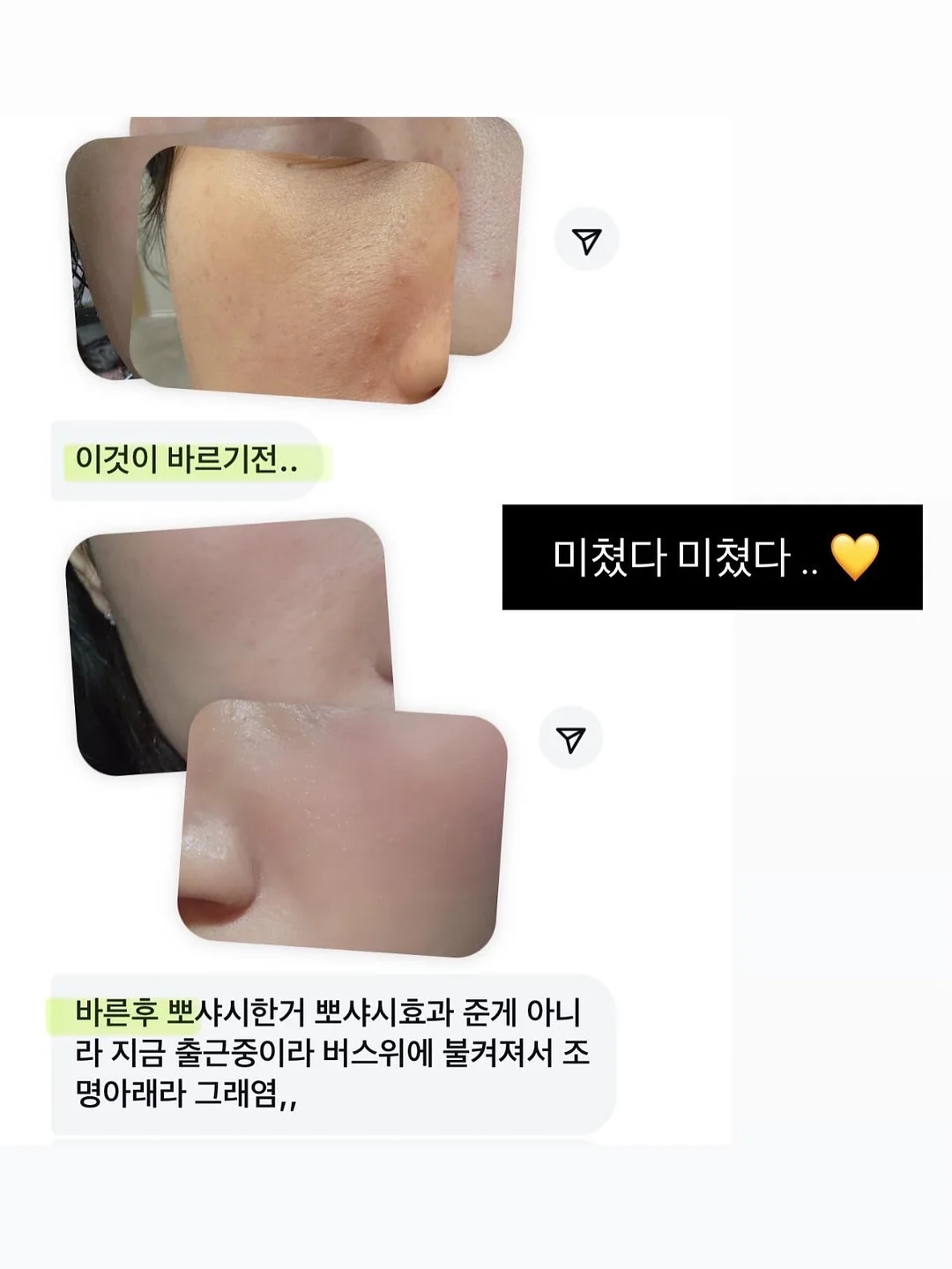 여름 하프 기장 아이템 14