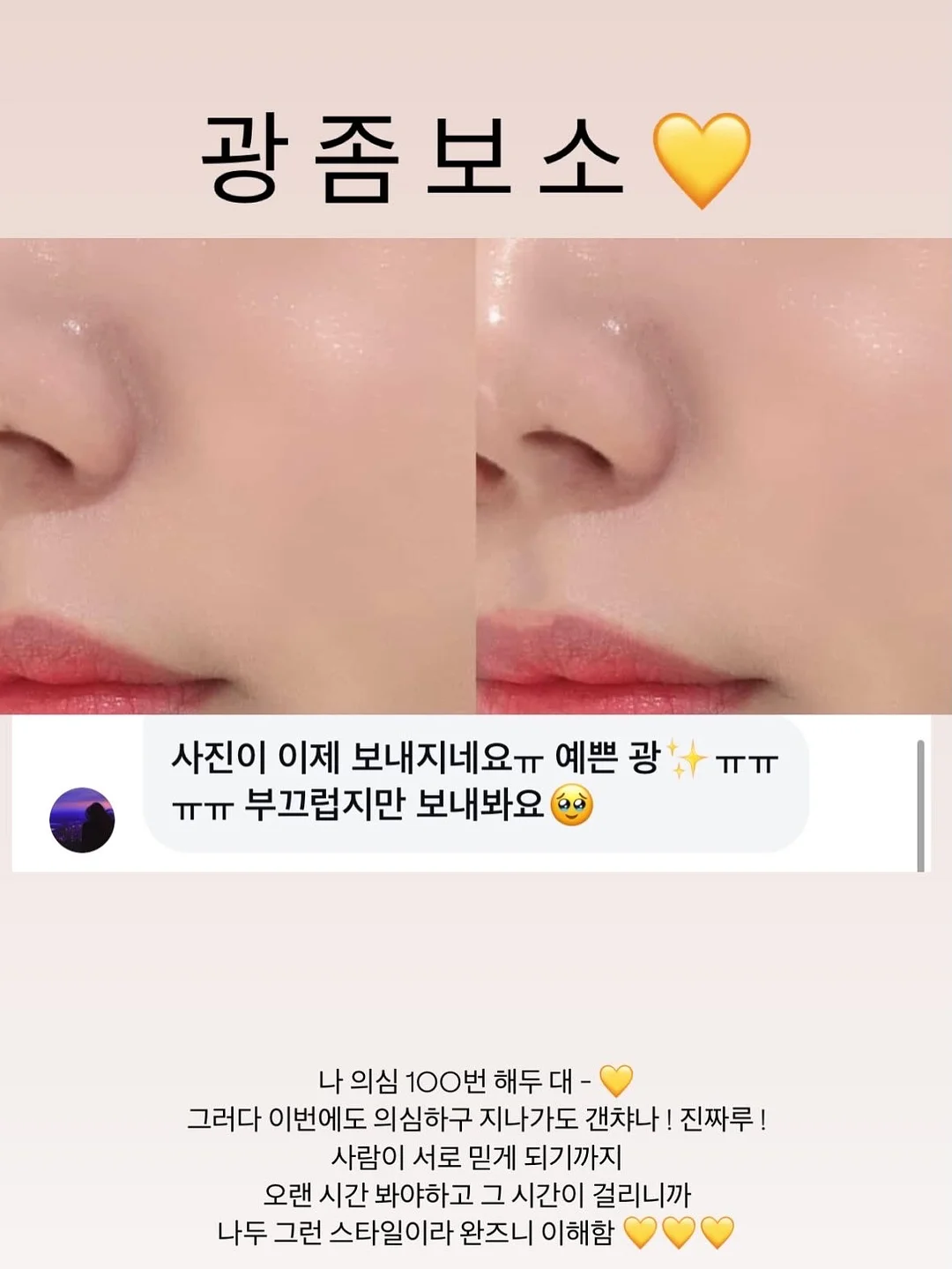 여름 하프 기장 아이템 10