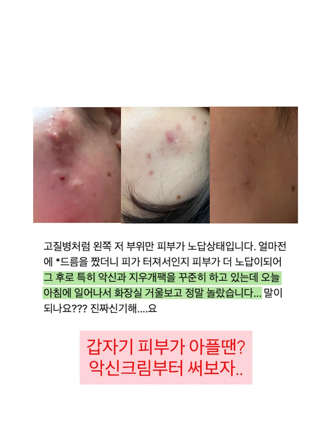 정부 지원 에너지 바우처 10