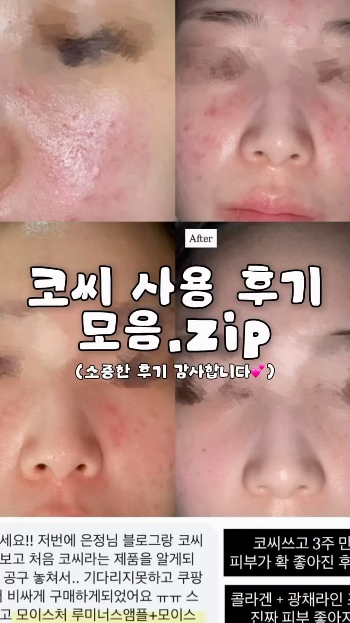 옐로우 스트라이프 숄더백