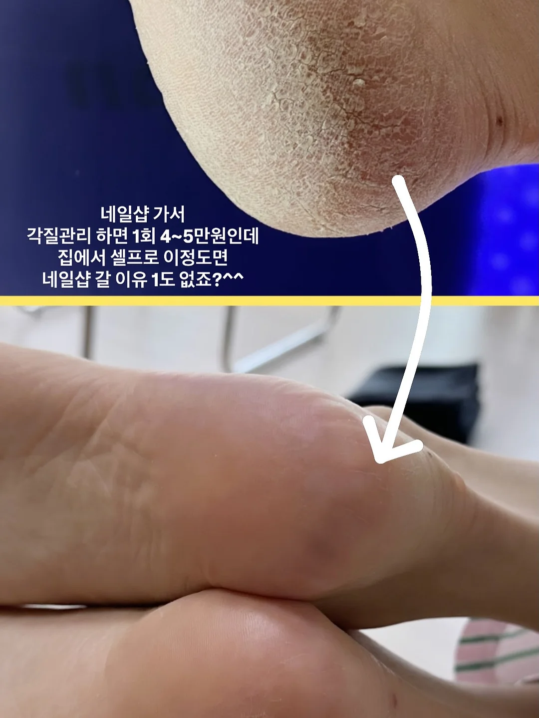 애플 초당옥수수 12