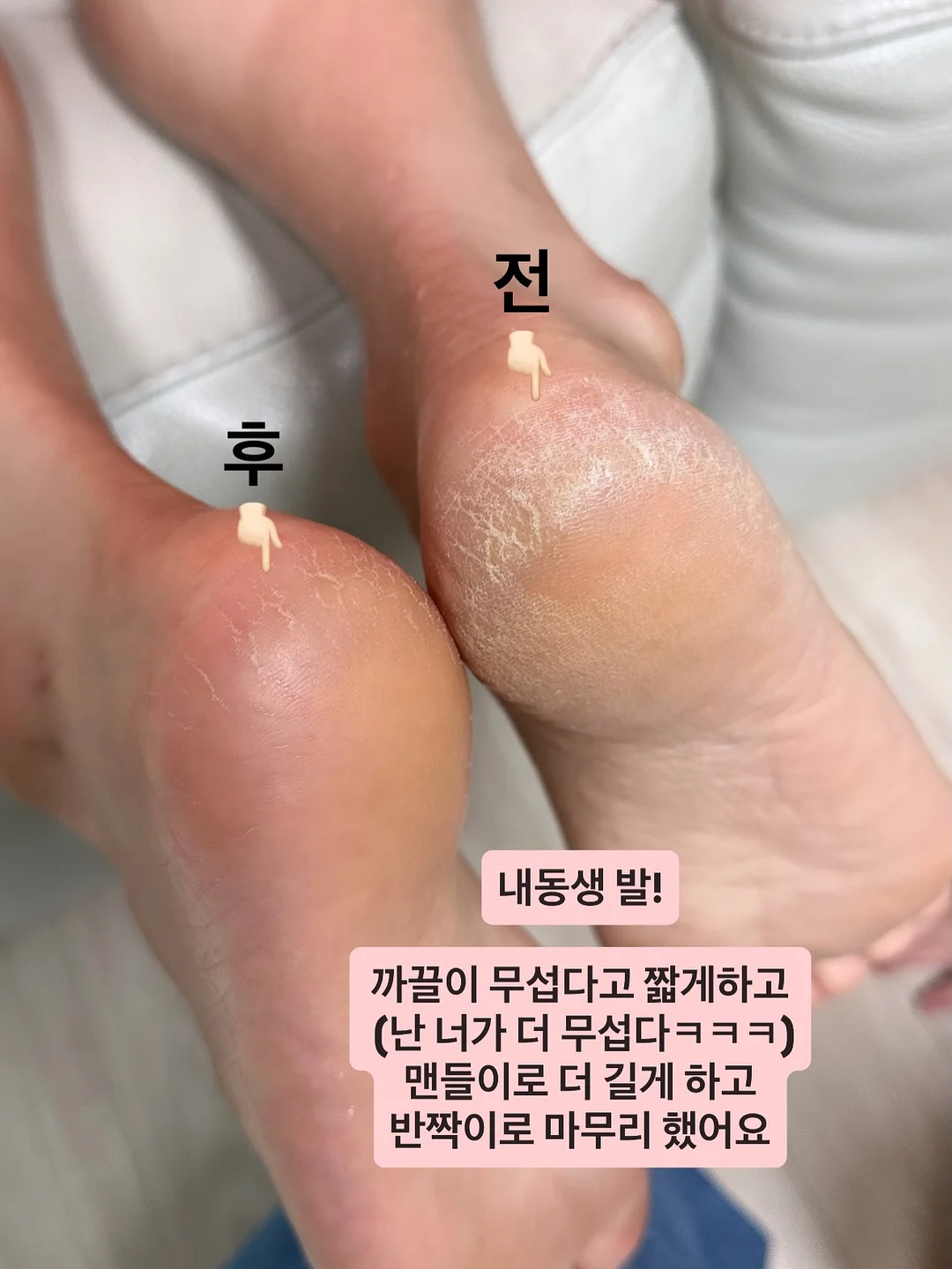 애플 초당옥수수 3