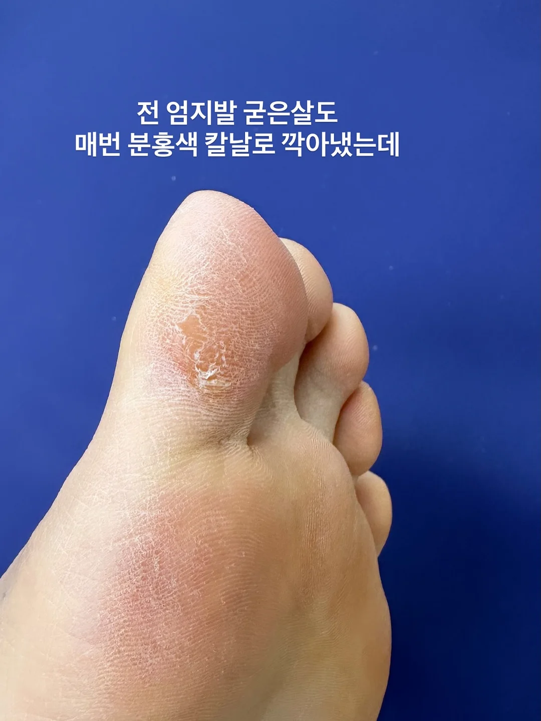 애플 초당옥수수 9