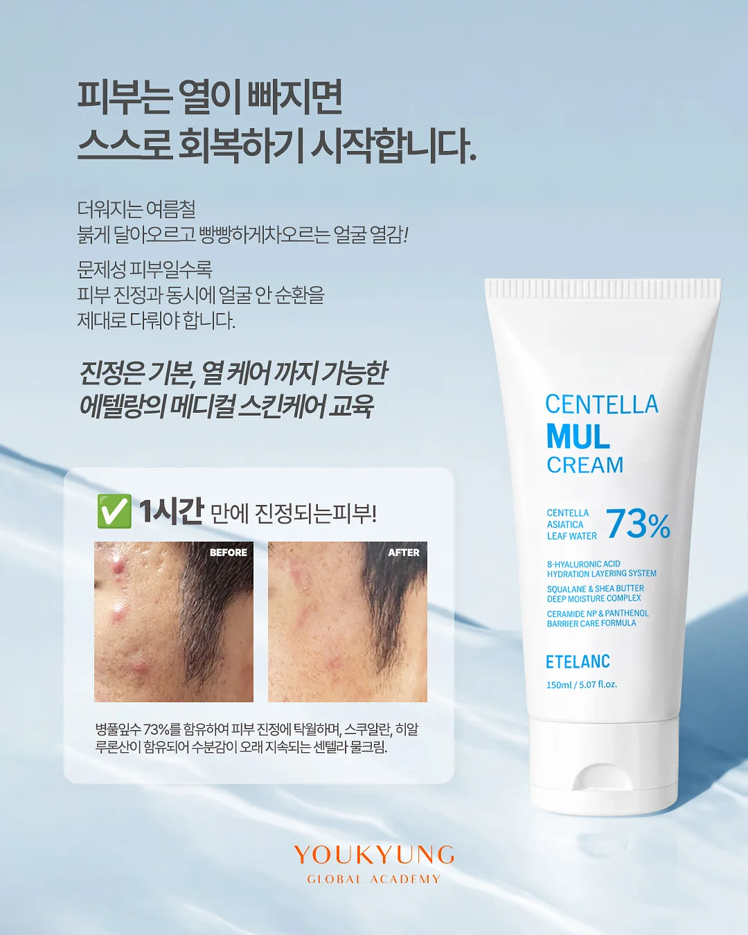 스트라이프 지지미 원피스