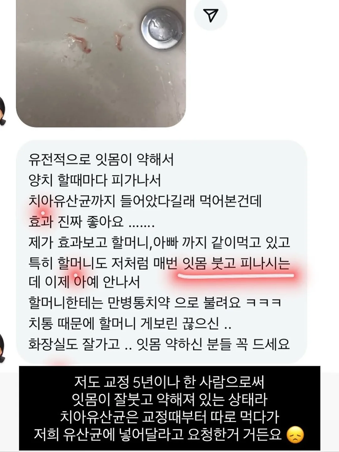 로봇손 5