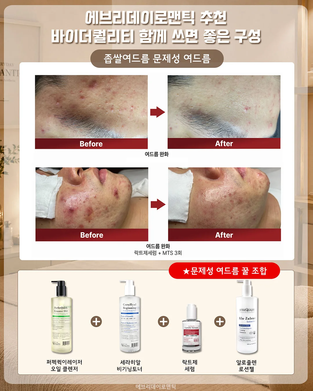 비피유 유산균 1