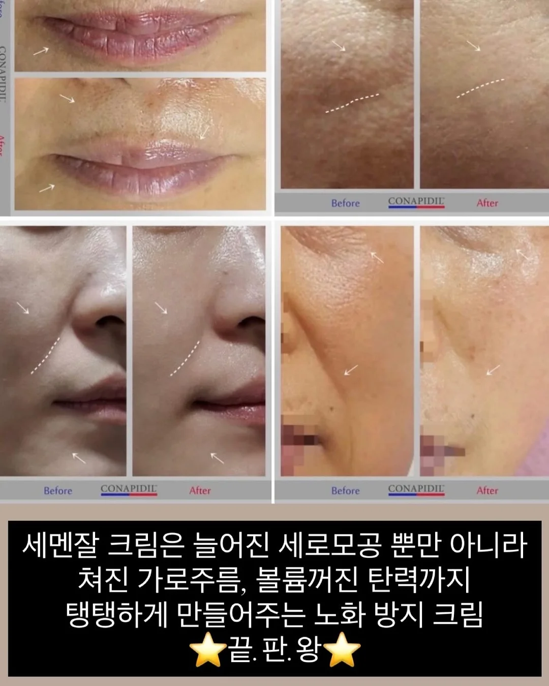 맥세이프 에폭시 범퍼 실버 케이스 4
