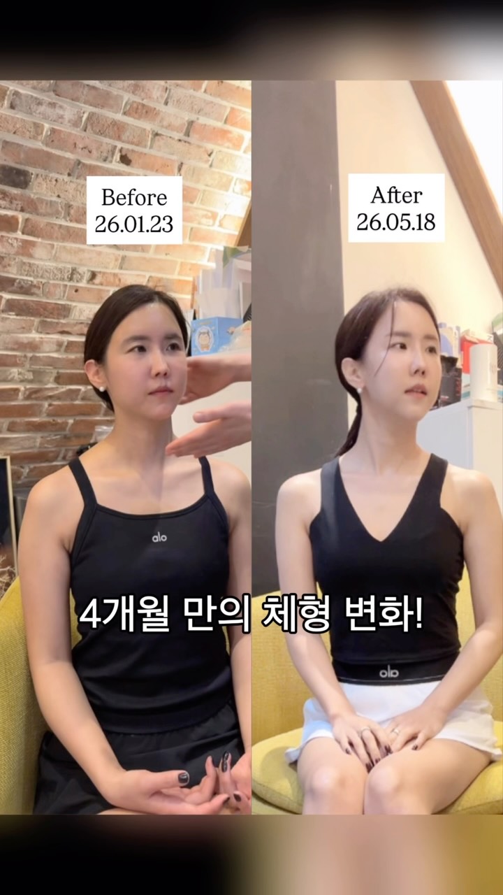우아 블라우스