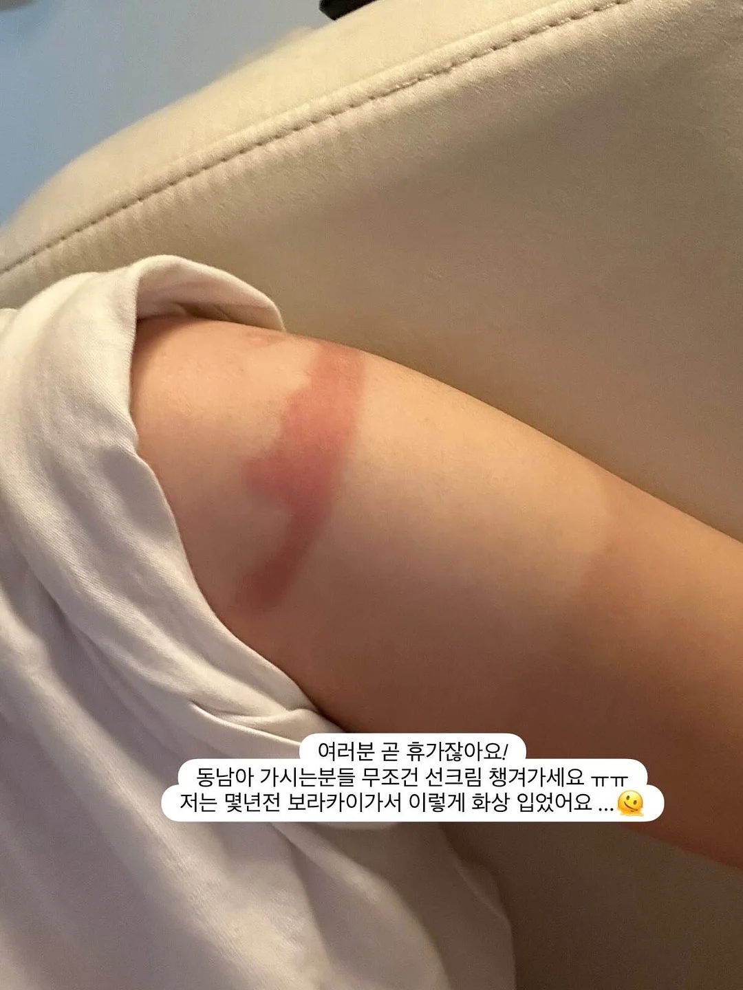 레이스 포인트 배색 티셔츠 5