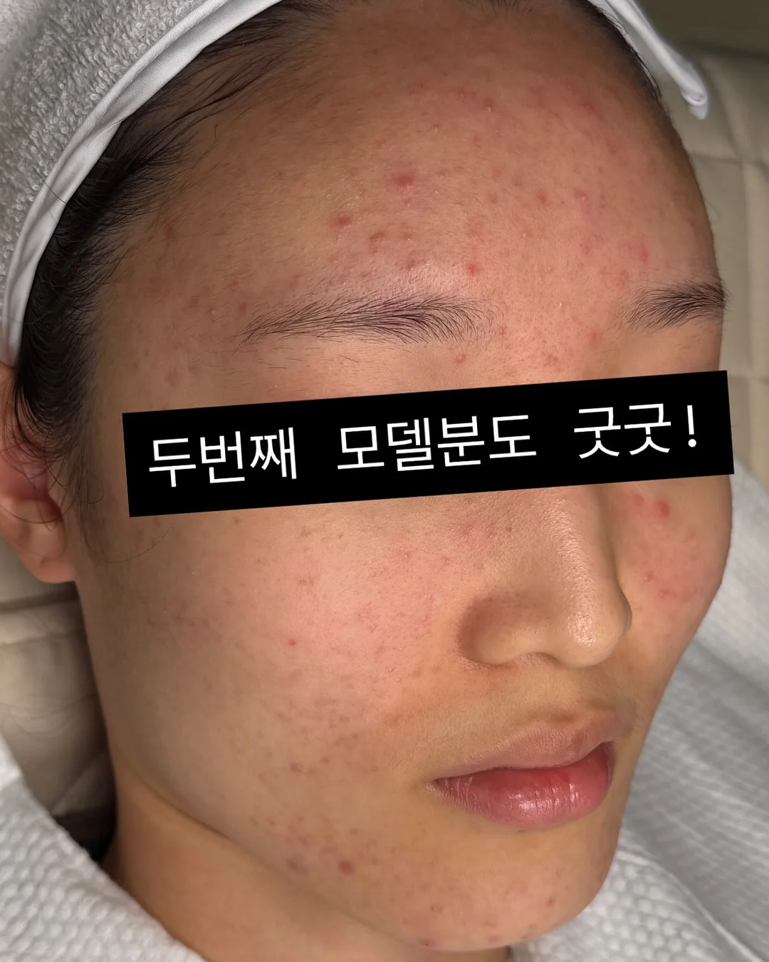 모기패치 15