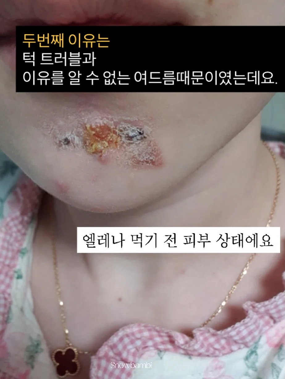 철심없는 스테이플러 5