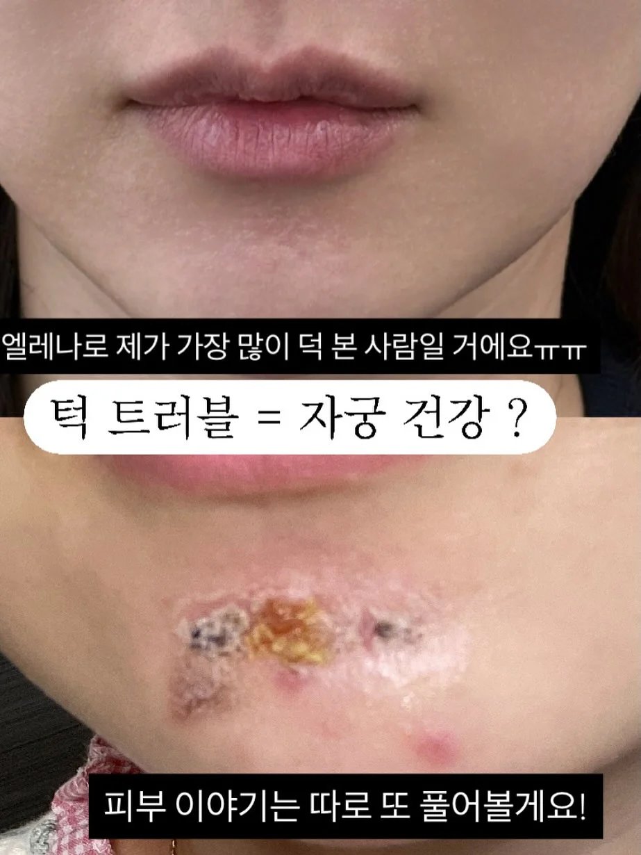 철심없는 스테이플러 6