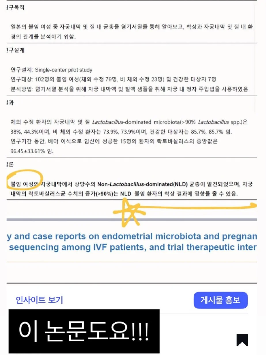 철심없는 스테이플러 8