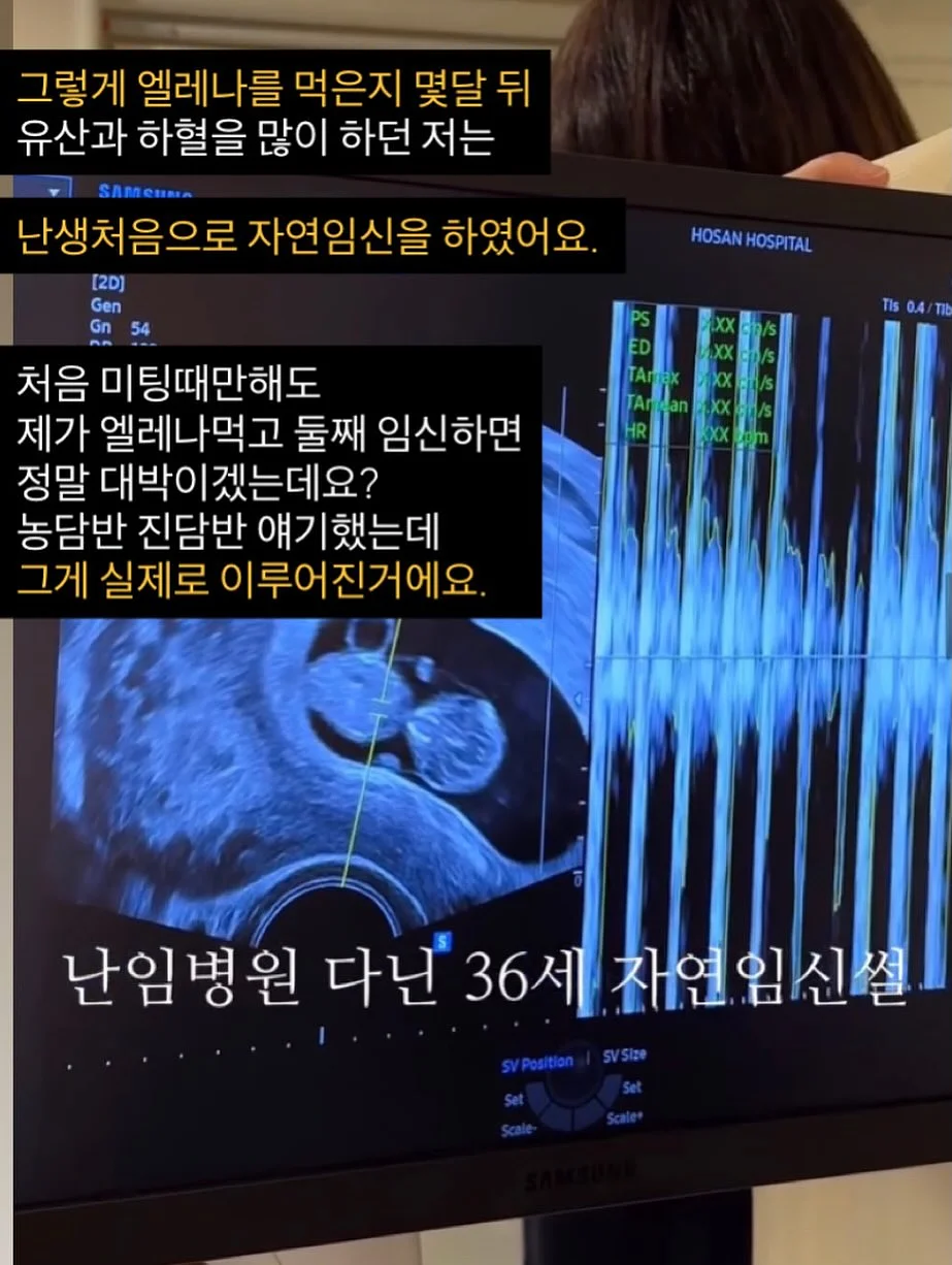 철심없는 스테이플러 9