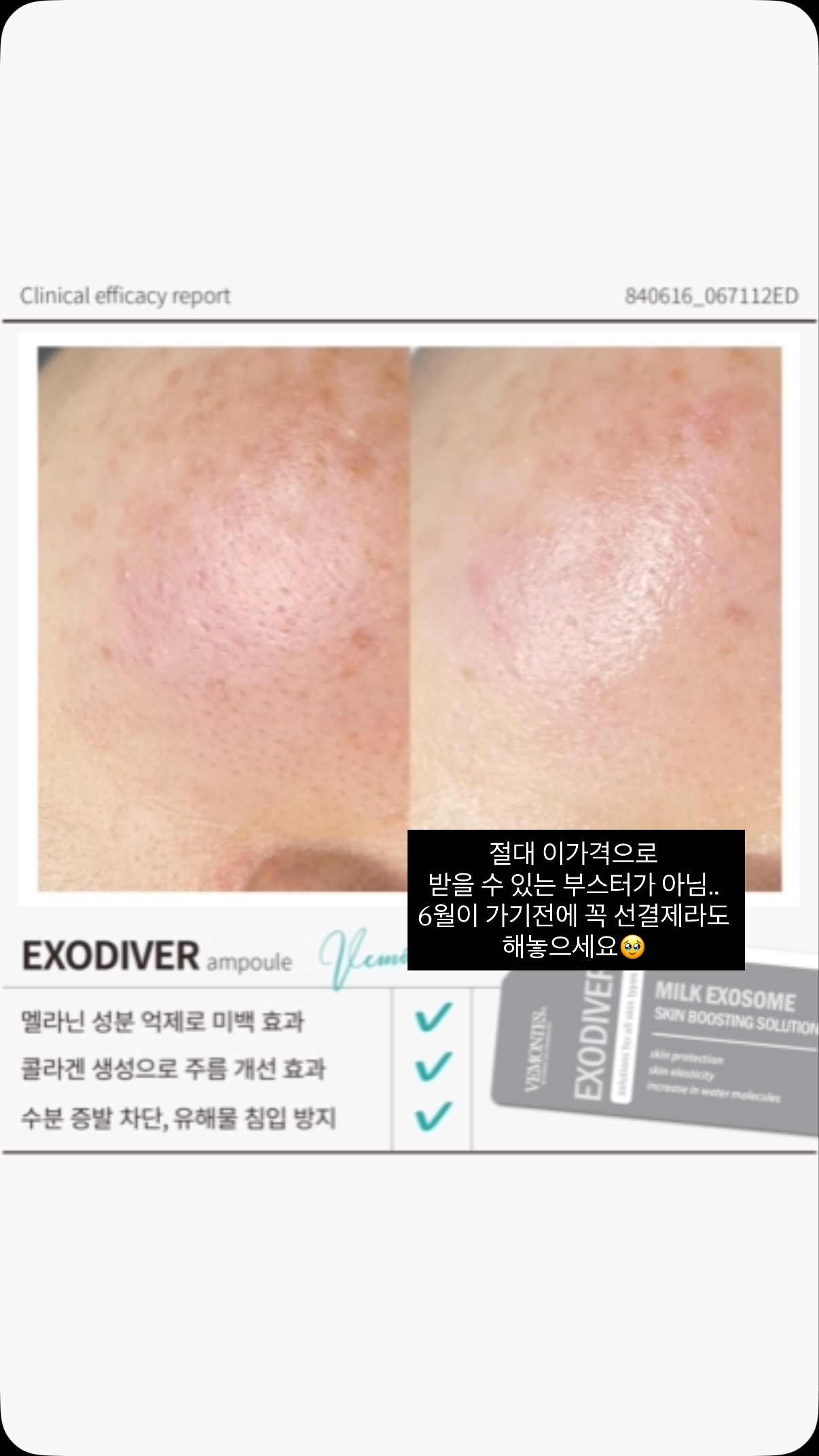 보부상 리빙백