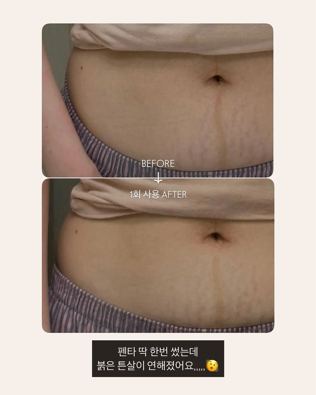 목련 파이 1