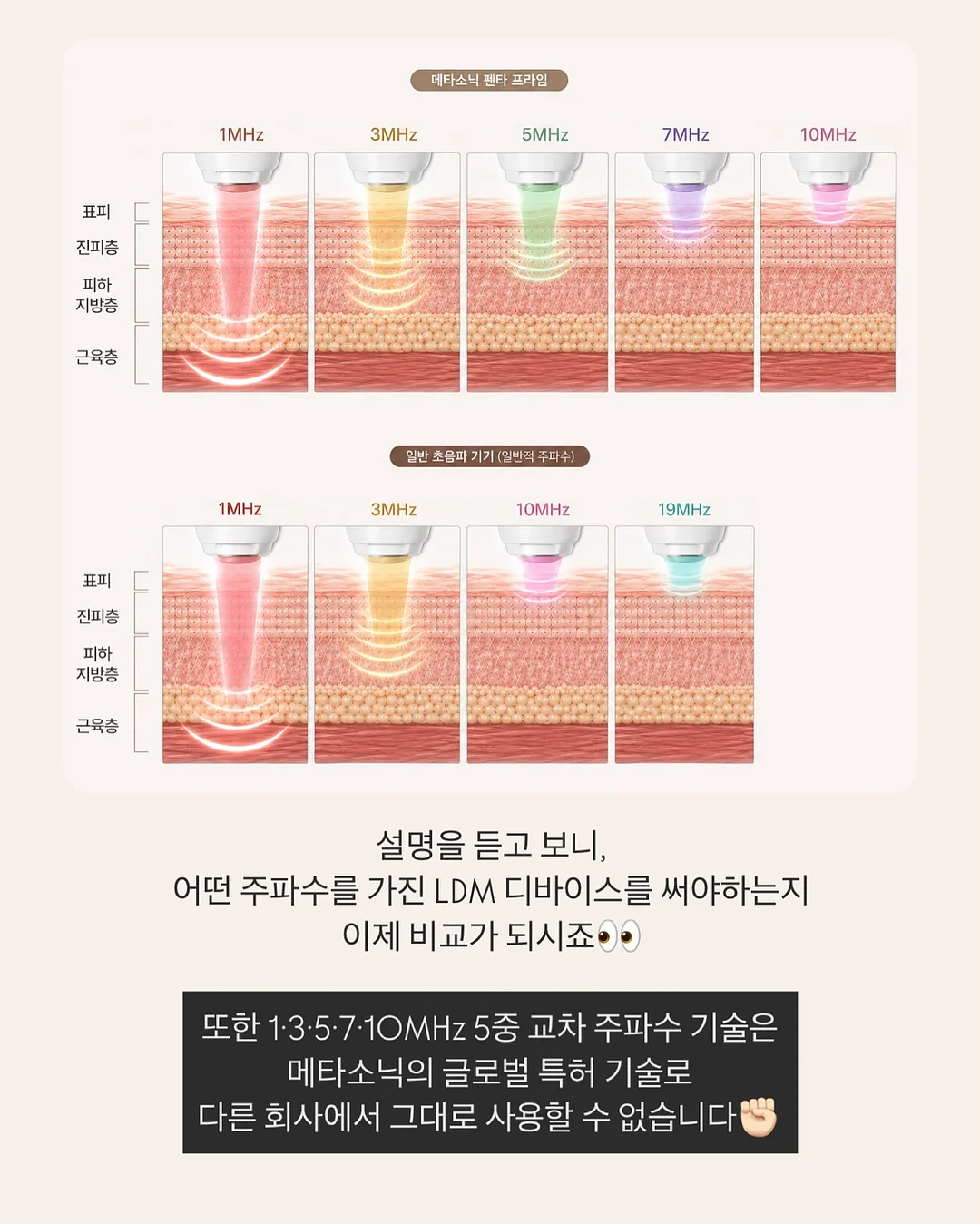 목련 파이 11