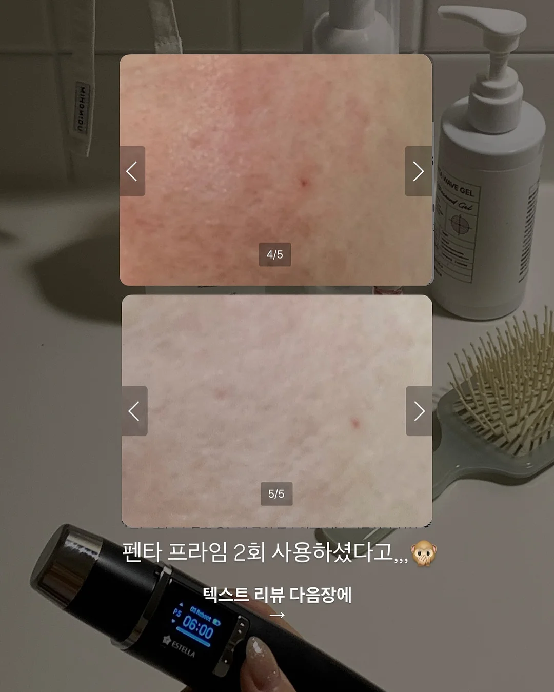 목련 파이 17