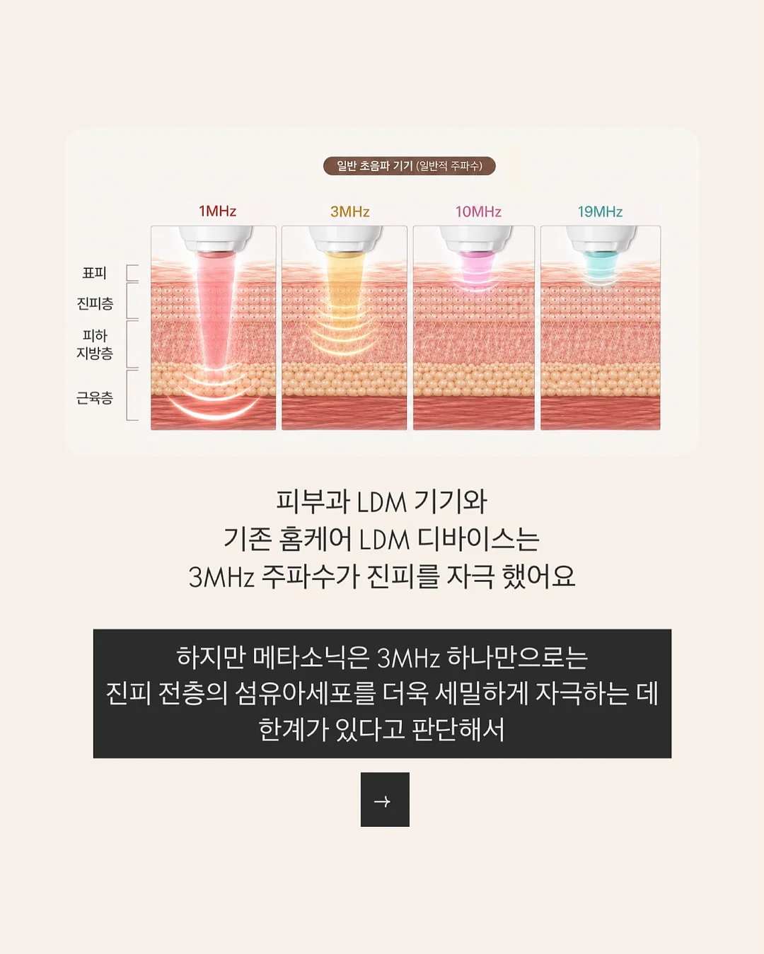 목련 파이 9