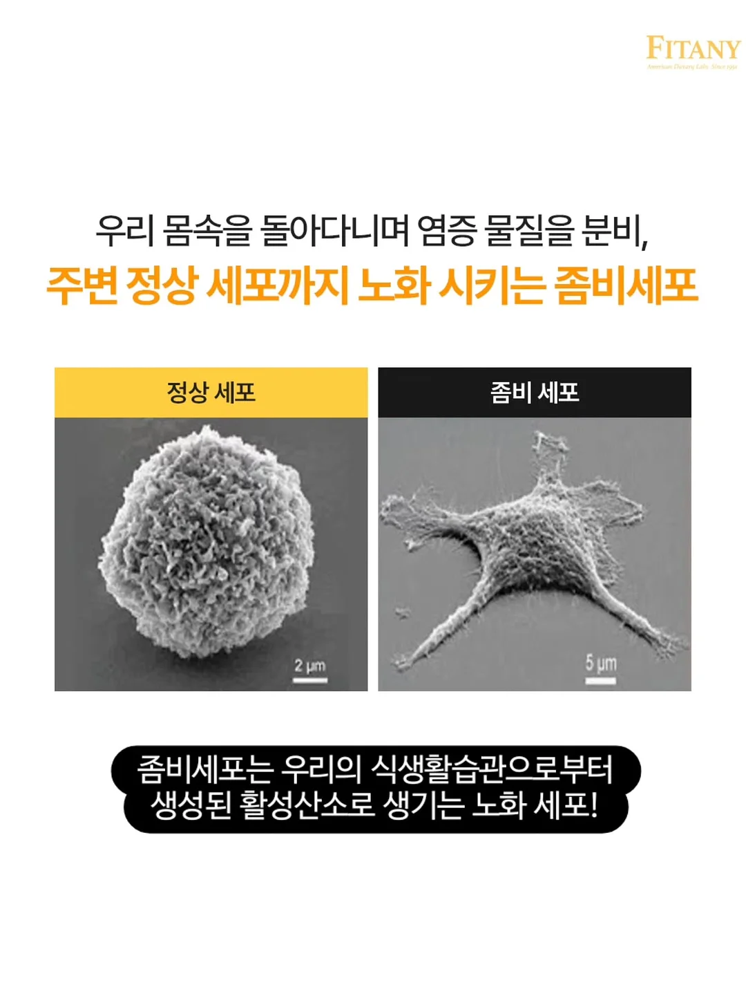 안탈라 오르샴푸 2