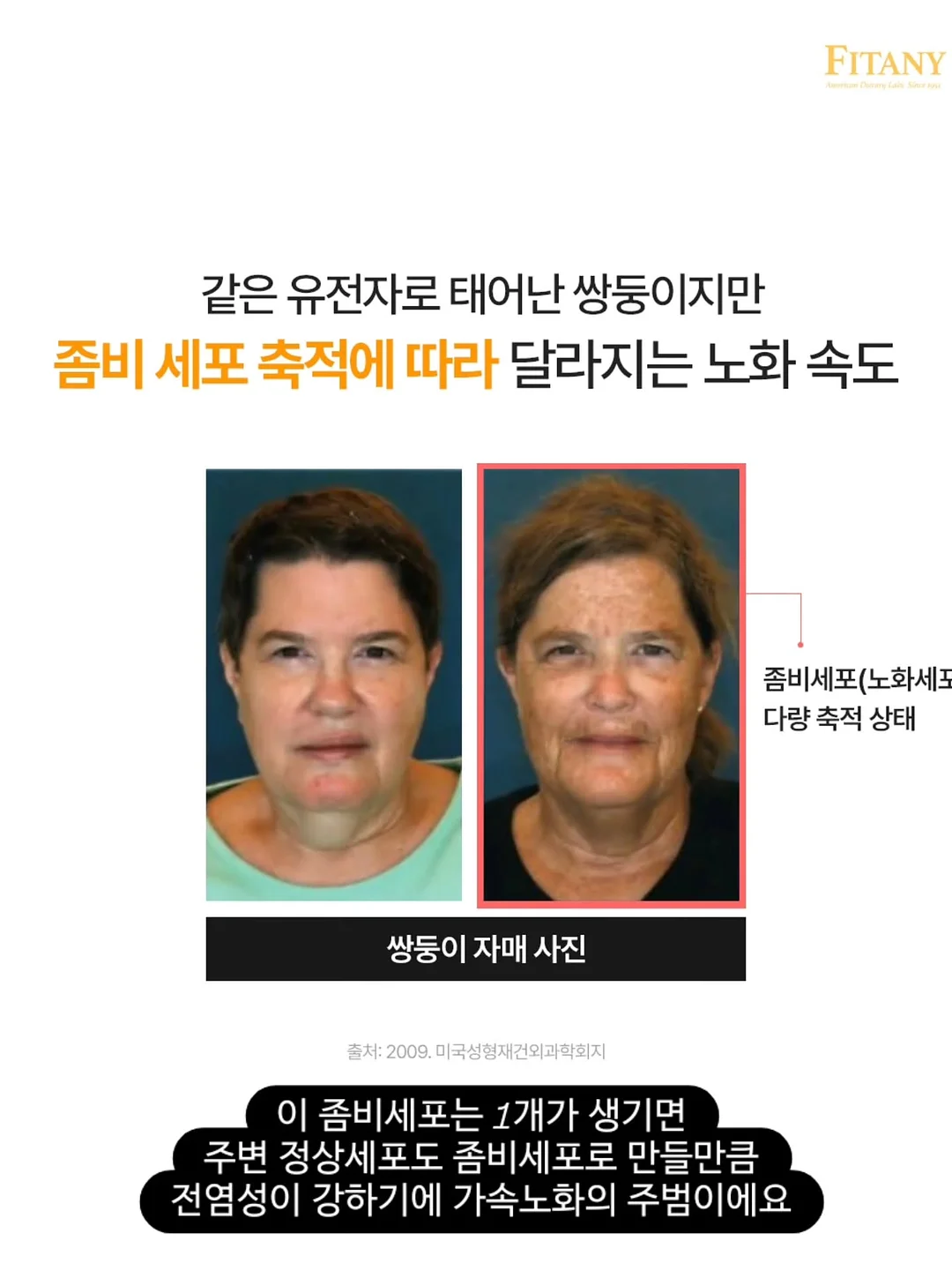 안탈라 오르샴푸 3