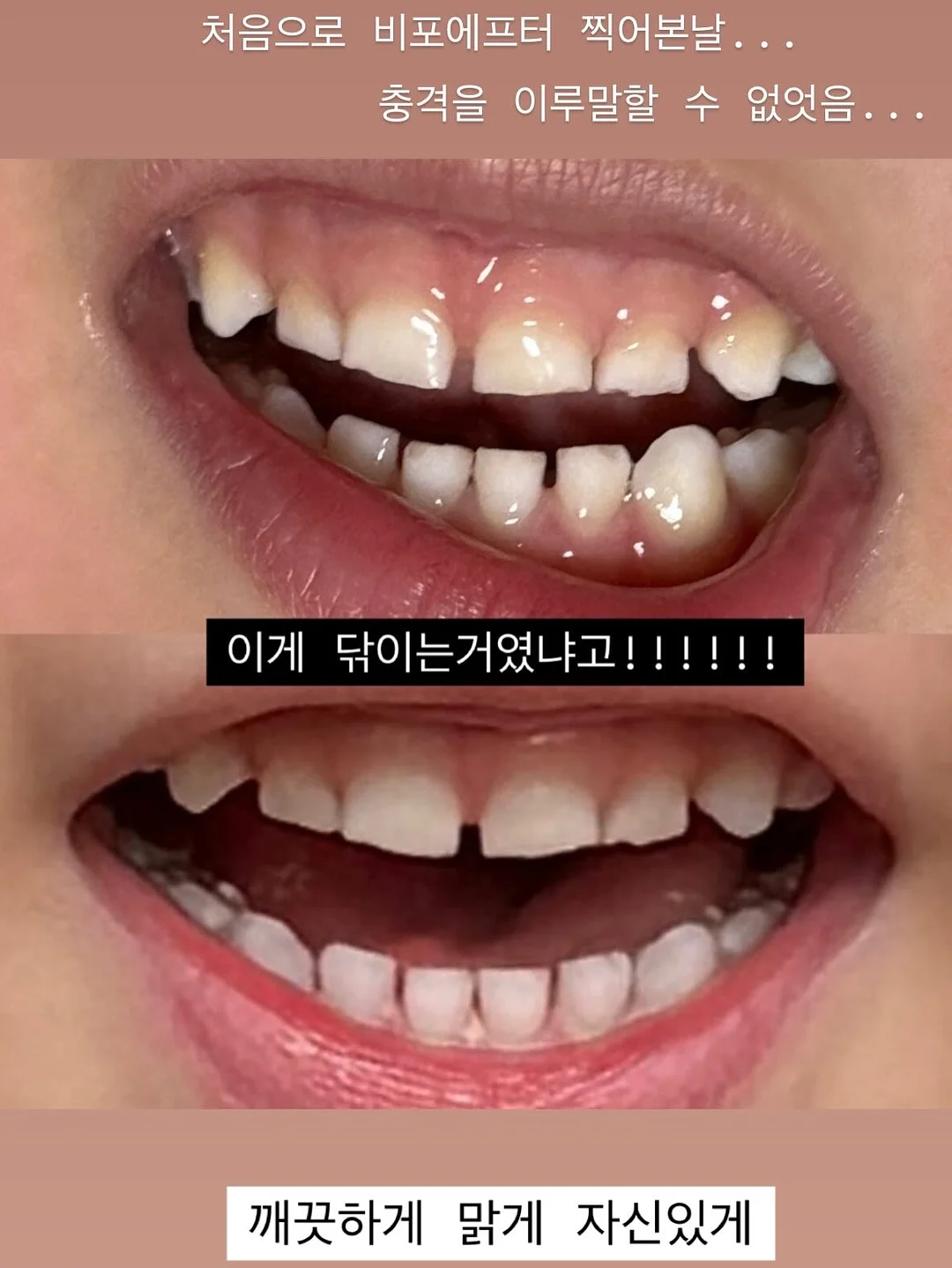 에어리스 분사기 7