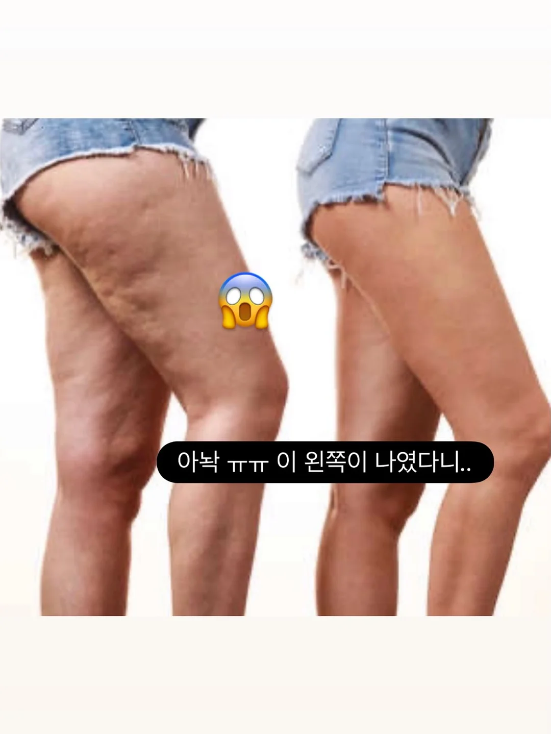 허스텔러 퍼스트 에센스 3