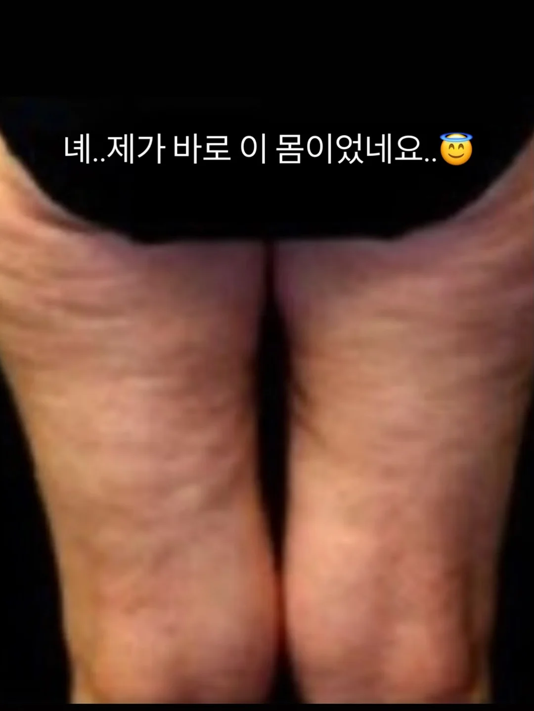 허스텔러 퍼스트 에센스 4