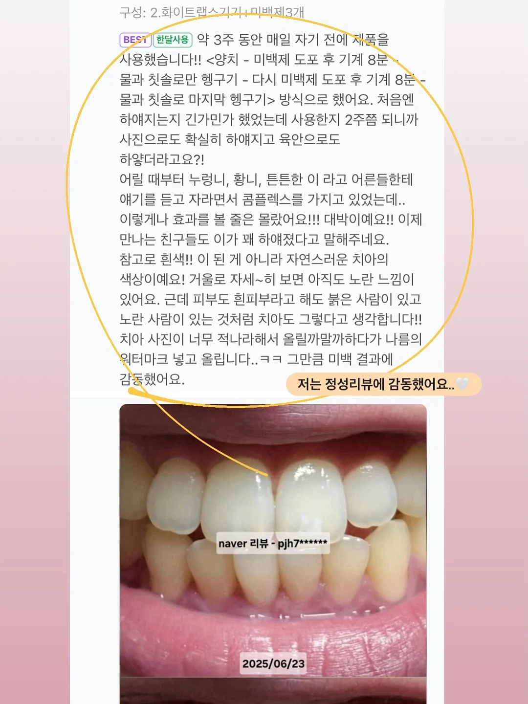 실키한 원피스 3
