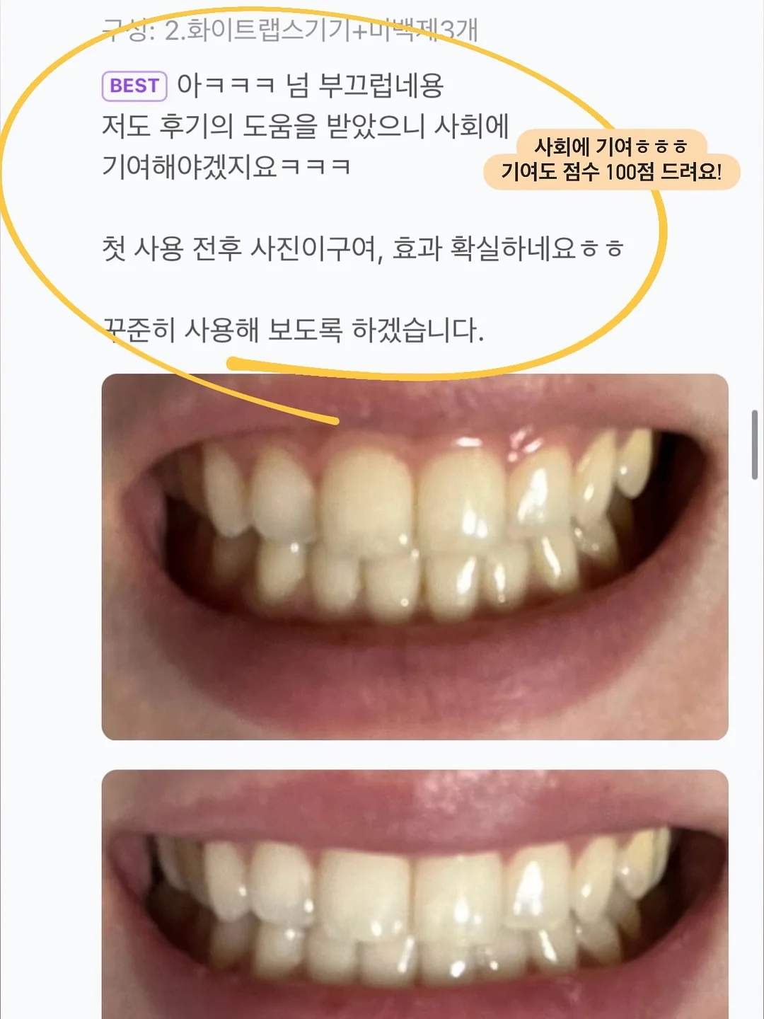 실키한 원피스 5