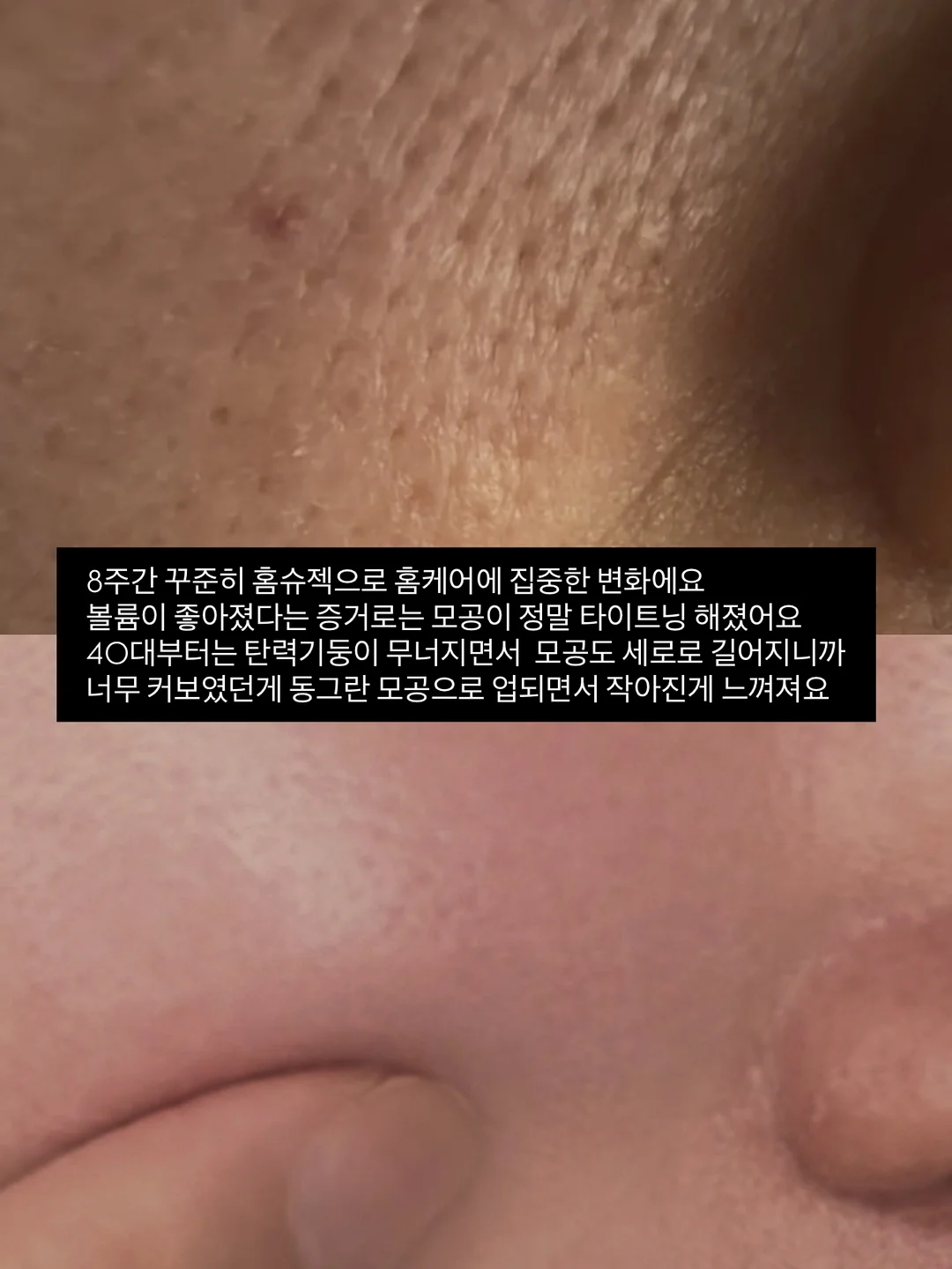 여드름 비누 11