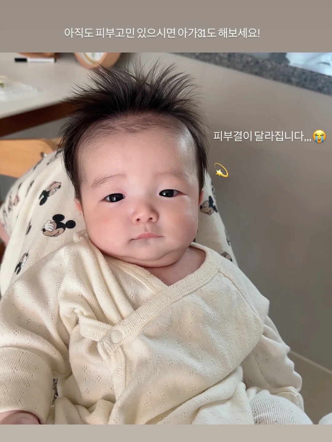 노탈리 텐텐 미스트 120ml 1