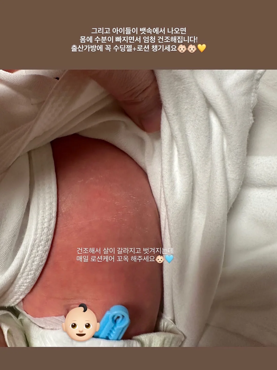 노탈리 텐텐 미스트 120ml 3