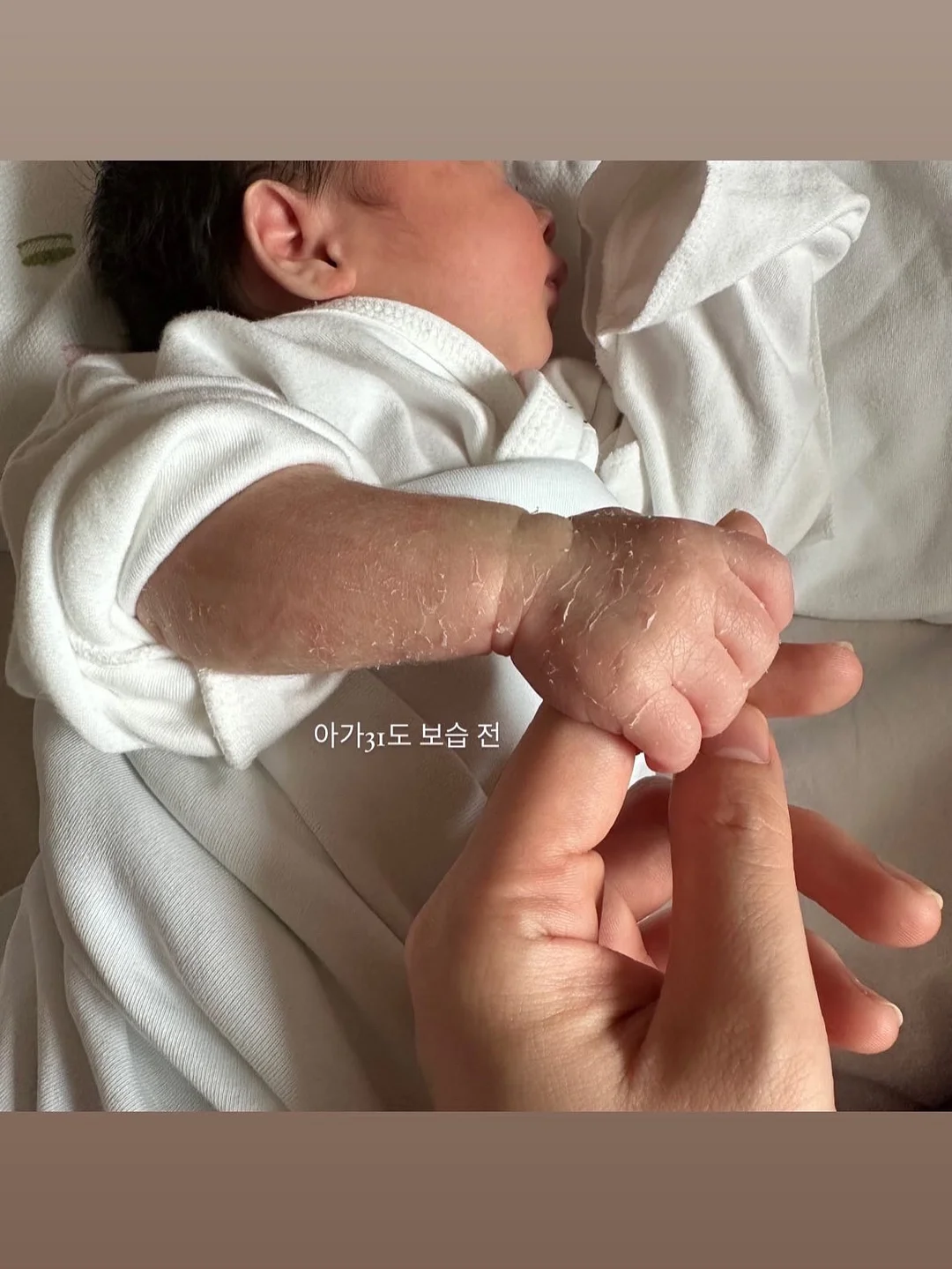 노탈리 텐텐 미스트 120ml 5