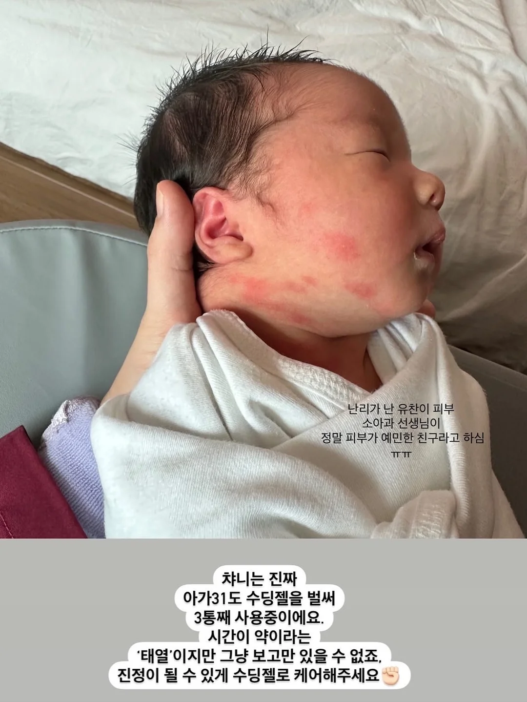 노탈리 텐텐 미스트 120ml 8