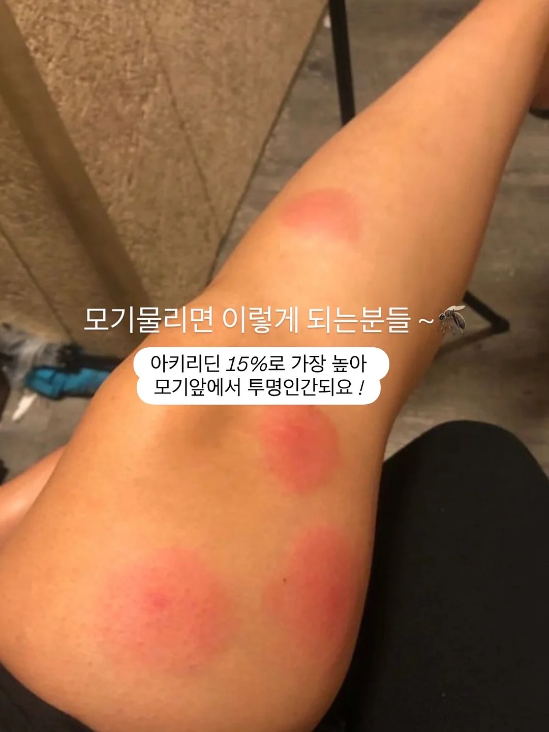 폴pk남매룩 티셔츠 및 원피스 세트 1