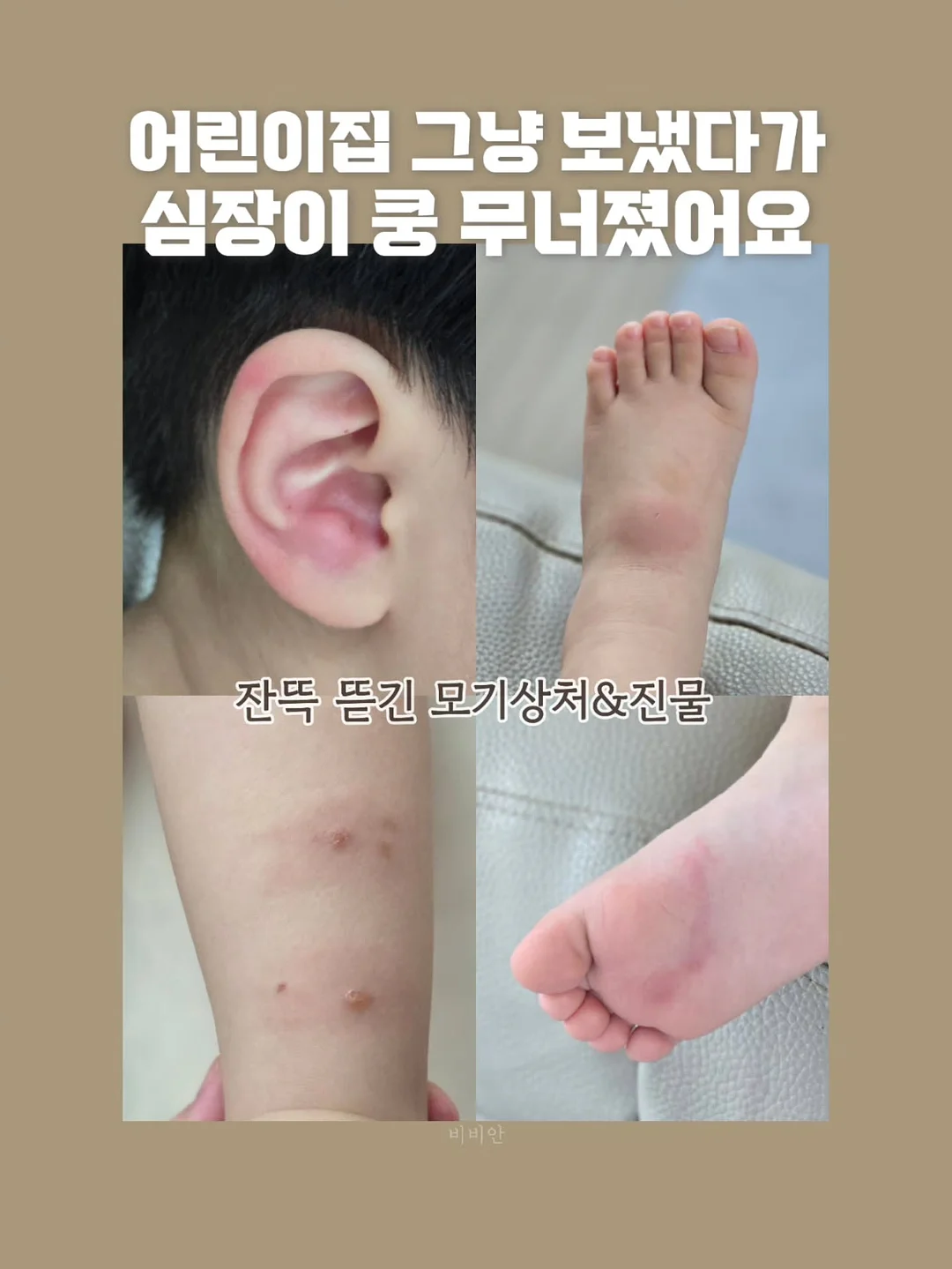 미니백 16