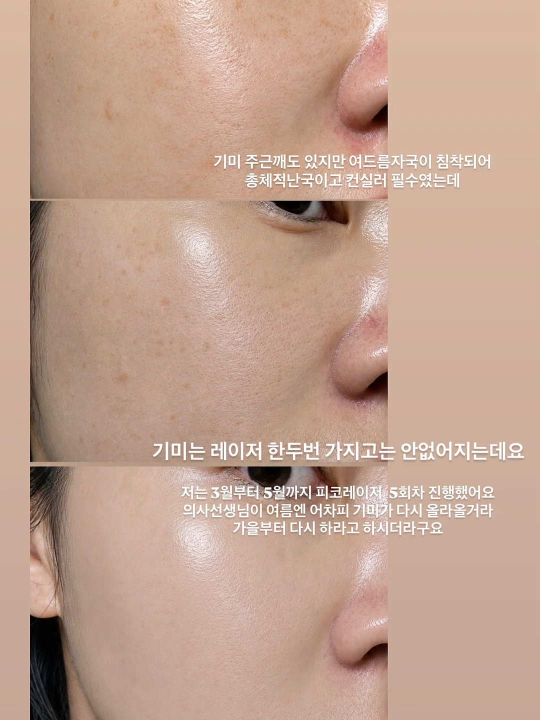 구제브이T 16