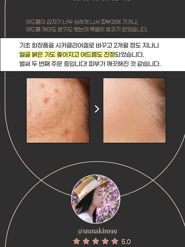 측두근 상부승모근 관리 4