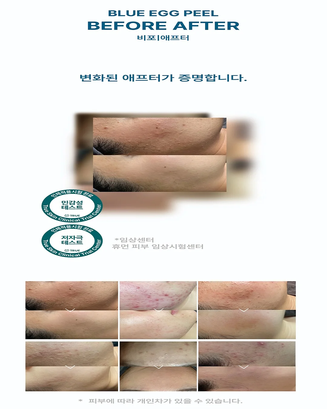 갱선생의 기적의 다이어트 3
