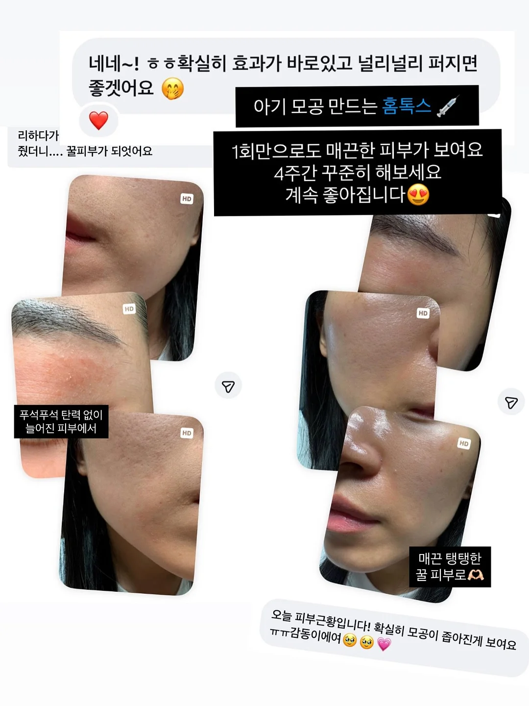 파데프리 쫀쫀광 피부 2