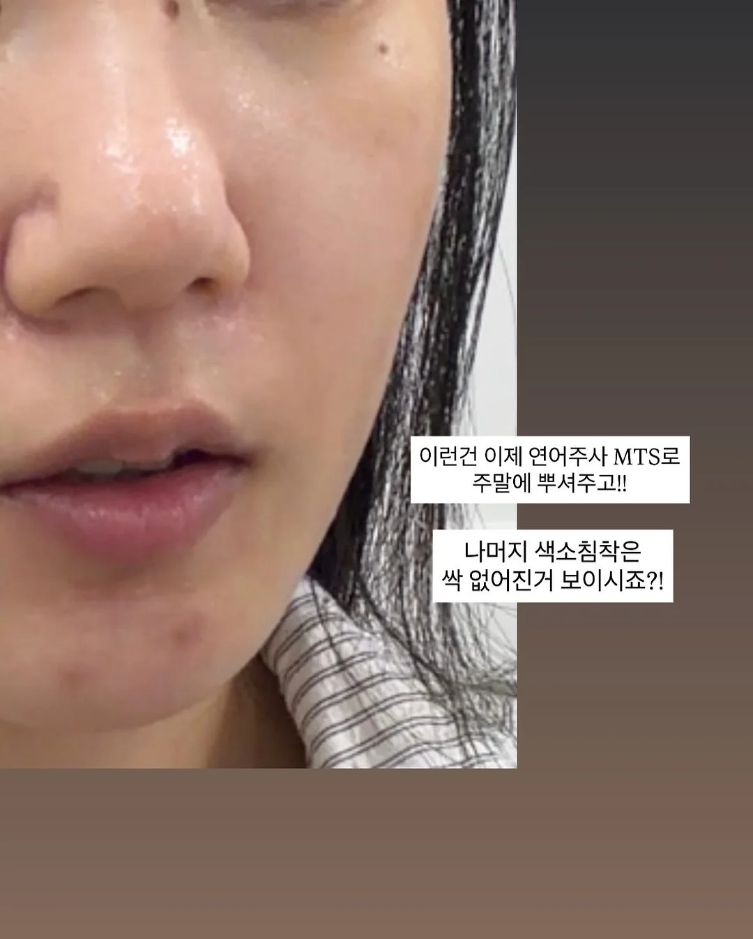 산마늘 버터 3
