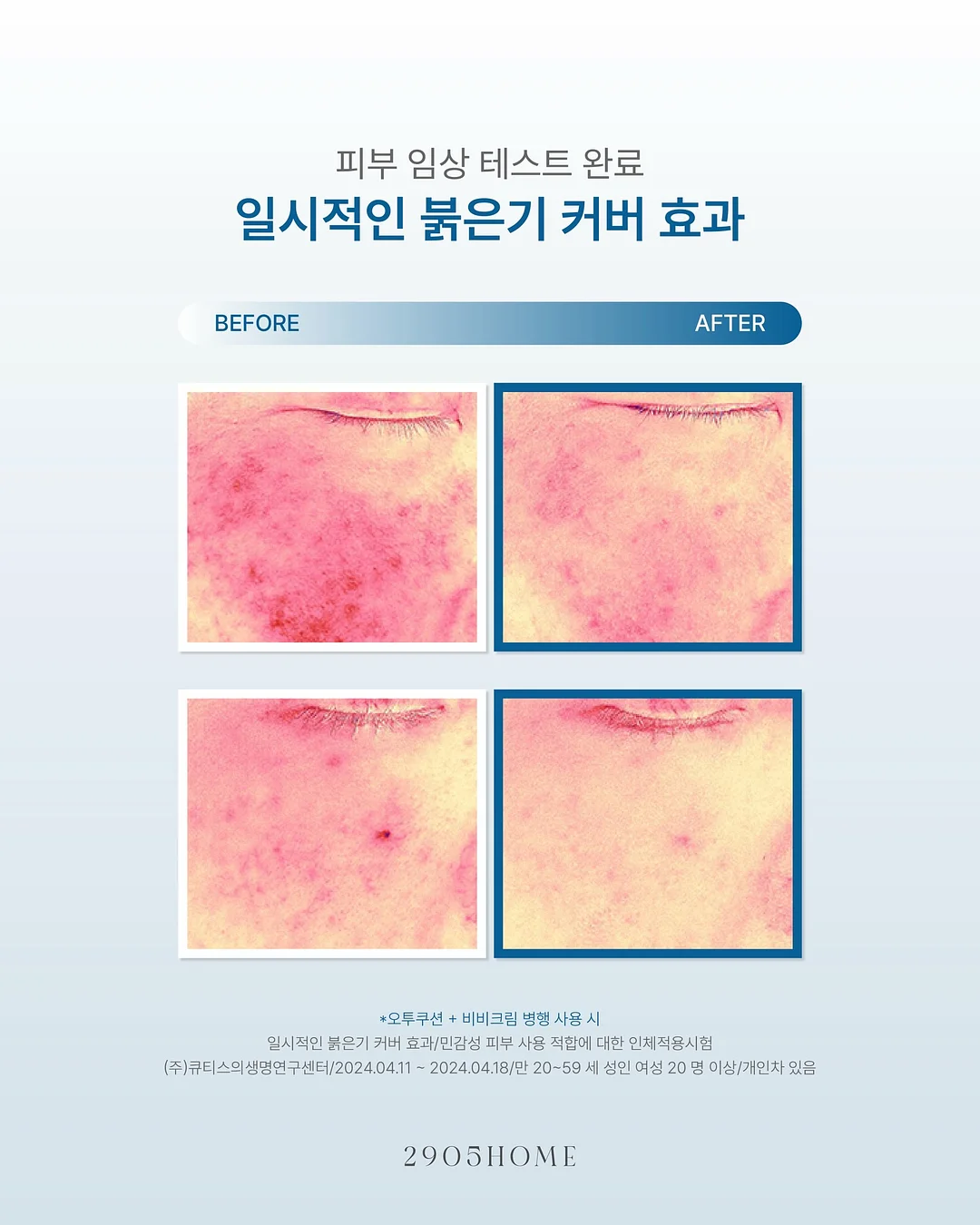 나이키 숏팬츠 18