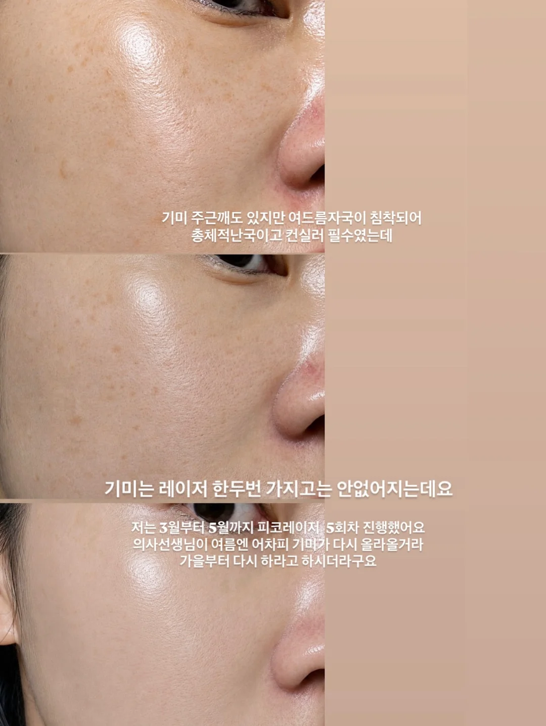 케처 고압세척기 2