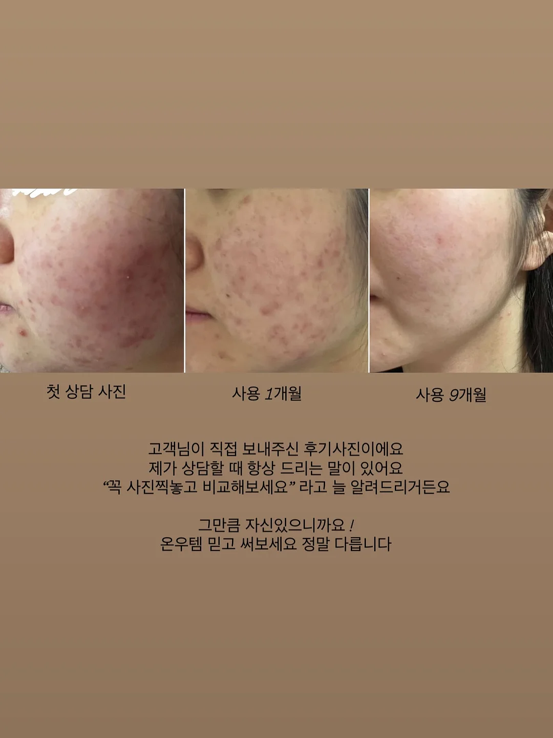 르꼬끄 폴로티 1