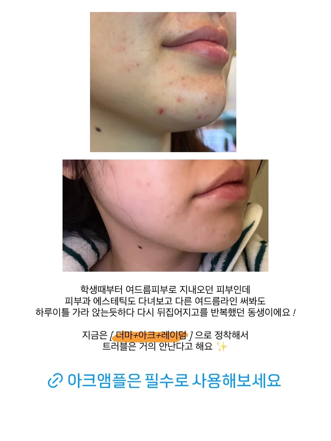 르꼬끄 폴로티 2