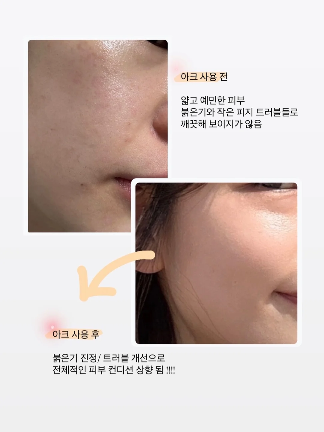 르꼬끄 폴로티 3