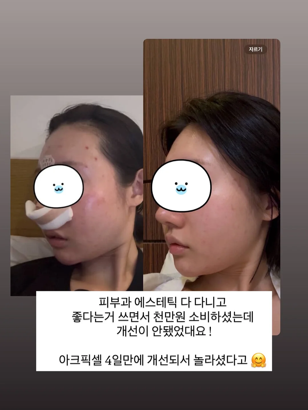 르꼬끄 폴로티 4